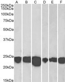 Anti-PARK7/DJ-1 antibody produced in goat affinity isolated antibody, buffered aqueous solution