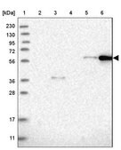 Anti-CEP85L antibody produced in rabbit Prestige Antibodies® Powered by Atlas Antibodies, affinity isolated antibody, buffered aqueous glycerol solution, ab1