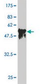 Monoclonal Anti-SERPINC1 antibody produced in mouse clone 2B12, purified immunoglobulin, buffered aqueous solution