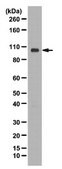 Anti-PDE11A Antibody from rabbit, purified by affinity chromatography