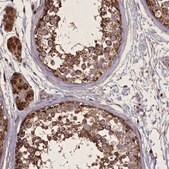 Anti-FAM96B antibody produced in rabbit Prestige Antibodies&#174; Powered by Atlas Antibodies, affinity isolated antibody, buffered aqueous glycerol solution