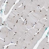 Anti-NFIX antibody produced in rabbit Prestige Antibodies&#174; Powered by Atlas Antibodies, affinity isolated antibody