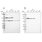 Anti-CARS antibody produced in rabbit Prestige Antibodies&#174; Powered by Atlas Antibodies, affinity isolated antibody, buffered aqueous glycerol solution