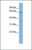 Anti-CYP4F3, (N-terminal) antibody produced in rabbit affinity isolated antibody