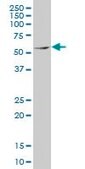 Monoclonal Anti-MEF2D antibody produced in mouse clone 3A11, purified immunoglobulin, buffered aqueous solution