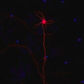 Neuro-Chrom Pan Neuronal Marker Antibody-Rabbit, Cy3 Conjugate Neuro-Chrom, from rabbit