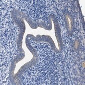 Anti-WIPI2 antibody produced in rabbit Prestige Antibodies&#174; Powered by Atlas Antibodies, affinity isolated antibody, buffered aqueous glycerol solution, Ab2