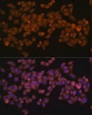 Anti-Fatty Acid Synthase (FASN) antibody produced in rabbit