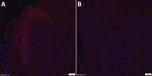 Anti-Calcitonin Gene Related Peptide Antibody serum, Chemicon®