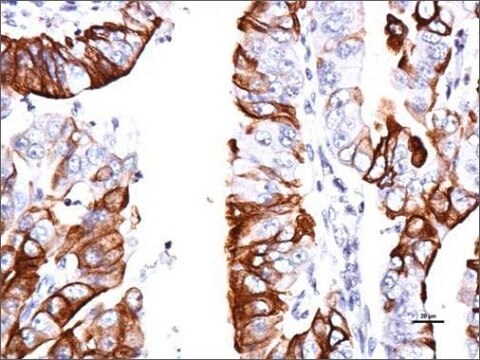 Anti-GPER (C-terminal) antibody produced in rabbit affinity isolated antibody, buffered aqueous solution