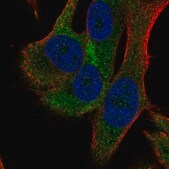 Anti-RPS18 antibody produced in rabbit Prestige Antibodies® Powered by Atlas Antibodies, affinity isolated antibody
