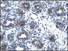 Anti-SLC1A2 affinity isolated antibody