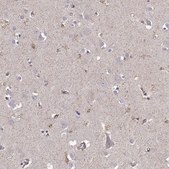 Anti-KCNMB4 antibody produced in rabbit Prestige Antibodies&#174; Powered by Atlas Antibodies, affinity isolated antibody