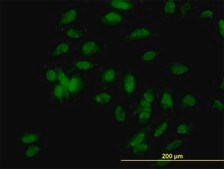 Monoclonal Anti-UBE3A antibody produced in mouse clone 2F6, purified immunoglobulin, buffered aqueous solution