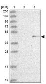 Anti-ZNF239 antibody produced in rabbit Prestige Antibodies® Powered by Atlas Antibodies, affinity isolated antibody, buffered aqueous glycerol solution