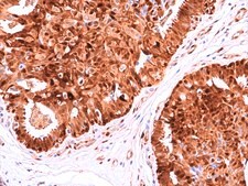 Anti-HSP70 Rabbit Monoclonal Antibody affinity purified immunoglobulin