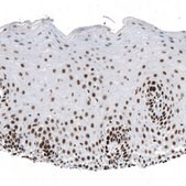 Monoclonal Anti-SETD2 antibody produced in mouse Prestige Antibodies&#174; Powered by Atlas Antibodies, clone CL9956, purified immunoglobulin, buffered aqueous glycerol solution