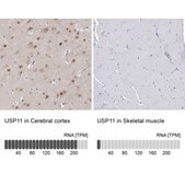 Anti-USP11 antibody produced in rabbit Prestige Antibodies® Powered by Atlas Antibodies, affinity isolated antibody, buffered aqueous glycerol solution