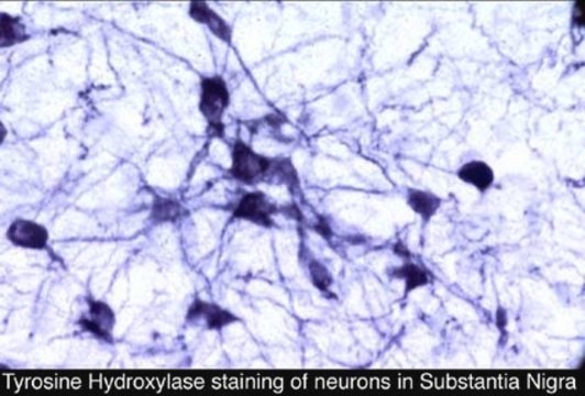 Anti-Tyrosine Hydroxylase Antibody serum, Chemicon&#174;