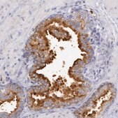 Anti-RAB27A antibody produced in rabbit Prestige Antibodies&#174; Powered by Atlas Antibodies, affinity isolated antibody, buffered aqueous glycerol solution