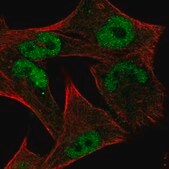 Anti-MYC antibody produced in rabbit Prestige Antibodies&#174; Powered by Atlas Antibodies, affinity isolated antibody