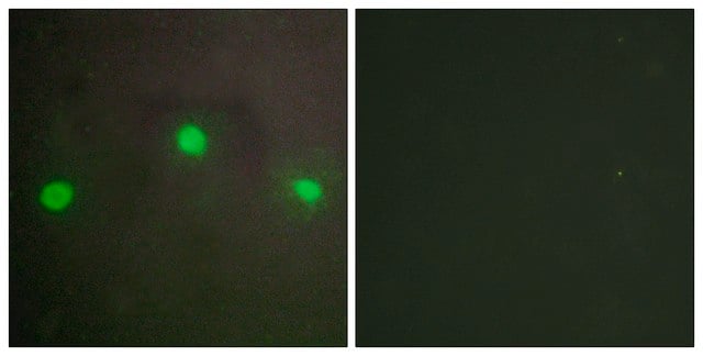 Anti-ATRX antibody produced in rabbit affinity isolated antibody