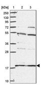 Anti-RPS18 antibody produced in rabbit Prestige Antibodies® Powered by Atlas Antibodies, affinity isolated antibody, buffered aqueous glycerol solution