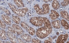 Anti-Cathepsin B Antibody, clone 1G7 ZooMAb® Rabbit Monoclonal recombinant, expressed in HEK 293 cells