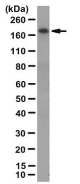 Anti-Rho GTPase-activating protein 23 Antibody from rabbit, purified by affinity chromatography
