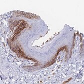 Anti-SLC2A1 antibody produced in rabbit affinity isolated antibody, buffered aqueous glycerol solution
