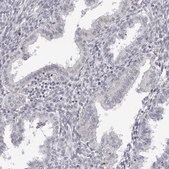 Anti-SUGCT antibody produced in rabbit Prestige Antibodies® Powered by Atlas Antibodies, affinity isolated antibody, buffered aqueous glycerol solution, ab1