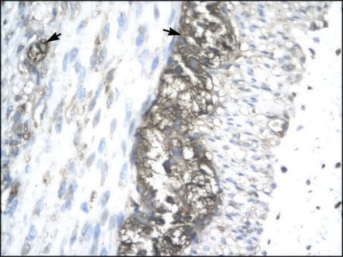 Anti-ACAT2 (AB2) antibody produced in rabbit IgG fraction of antiserum