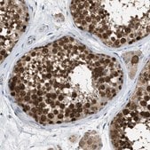 Anti-MIS18A antibody produced in rabbit Prestige Antibodies&#174; Powered by Atlas Antibodies, affinity isolated antibody, buffered aqueous glycerol solution