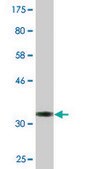 Monoclonal Anti-ARPC3, (N-terminal) antibody produced in mouse clone 2E11, purified immunoglobulin, buffered aqueous solution