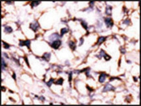 Anti-STK29 (center) antibody produced in rabbit IgG fraction of antiserum, buffered aqueous solution