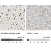 Anti-PRDM2 antibody produced in rabbit Prestige Antibodies® Powered by Atlas Antibodies, affinity isolated antibody, buffered aqueous glycerol solution
