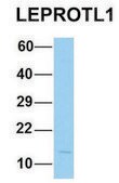 Anti-LEPROTL1 (N-terminal) antibody produced in rabbit affinity isolated antibody