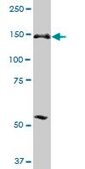 Anti-ERCC6L antibody produced in mouse purified immunoglobulin, buffered aqueous solution