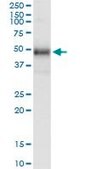 Monoclonal Anti-TRIB1 antibody produced in mouse clone 4A10, purified immunoglobulin, buffered aqueous solution