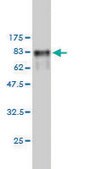 Monoclonal Anti-CCT6B antibody produced in mouse clone 1A4, purified immunoglobulin, buffered aqueous solution