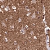 Anti-EPB41L1 antibody produced in rabbit Prestige Antibodies&#174; Powered by Atlas Antibodies, affinity isolated antibody, buffered aqueous glycerol solution