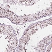 Anti-ZNF572 antibody produced in rabbit Prestige Antibodies® Powered by Atlas Antibodies, affinity isolated antibody, buffered aqueous glycerol solution