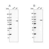 Anti-ARHGAP25 antibody produced in rabbit Prestige Antibodies&#174; Powered by Atlas Antibodies, affinity isolated antibody