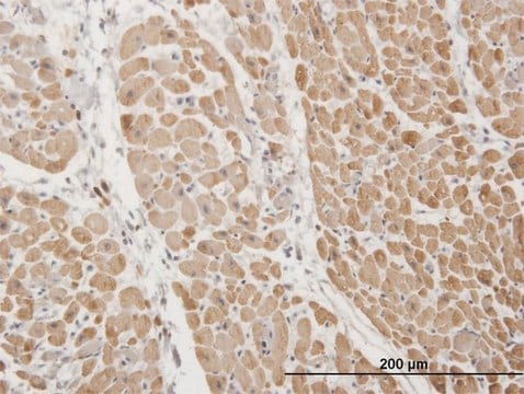 Monoclonal Anti-TNNI3 antibody produced in mouse clone 1E7, purified immunoglobulin, buffered aqueous solution