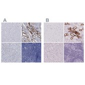 Anti-TMEM72 antibody produced in rabbit Prestige Antibodies® Powered by Atlas Antibodies, affinity isolated antibody, buffered aqueous glycerol solution