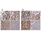 Anti-PEX13 antibody produced in rabbit Prestige Antibodies® Powered by Atlas Antibodies, affinity isolated antibody, buffered aqueous glycerol solution
