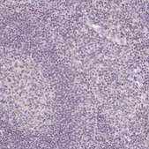 Anti-SLC6A18 antibody produced in rabbit Prestige Antibodies&#174; Powered by Atlas Antibodies, affinity isolated antibody, buffered aqueous glycerol solution