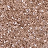 Anti-C2CD3 antibody produced in rabbit Prestige Antibodies&#174; Powered by Atlas Antibodies, affinity isolated antibody, buffered aqueous glycerol solution