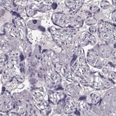 Anti-TSPYL5 antibody produced in rabbit Prestige Antibodies&#174; Powered by Atlas Antibodies, affinity isolated antibody, buffered aqueous glycerol solution