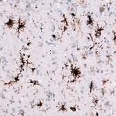 Monoclonal Anti-HLA-DRA antibody produced in mouse Prestige Antibodies® Powered by Atlas Antibodies, clone CL10964, purified antibody (Protein A)